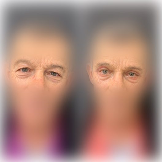 DR-ANTONIO-TEIXEIRA-ANTES-DEPOIS-0