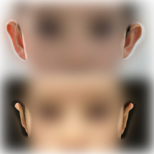 DR-ANTONIO-TEIXEIRA-ANTES-DEPOIS-03