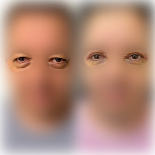 DR-ANTONIO-TEIXEIRA-ANTES-DEPOIS-05