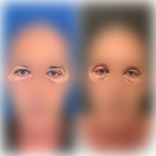 DR-ANTONIO-TEIXEIRA-ANTES-DEPOIS-06